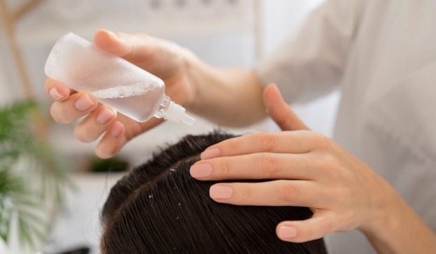 Mengatasi Ketombe Dengan Hair Tonic: Apakah Ampuh?